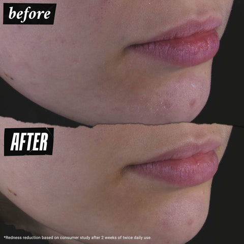 V2H1595690C66CA3590C04B9BBB23560CAAR7660223P6